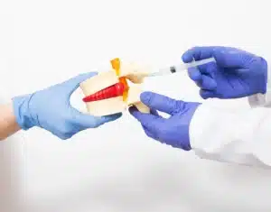 Mãos com luva azul segurando objeto que representa disco de coluna levando injeção