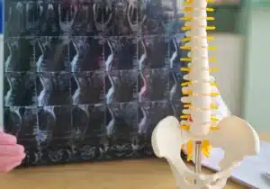 Modelo da coluna vertebral e imagens de raios X exibidas em um consultório médico